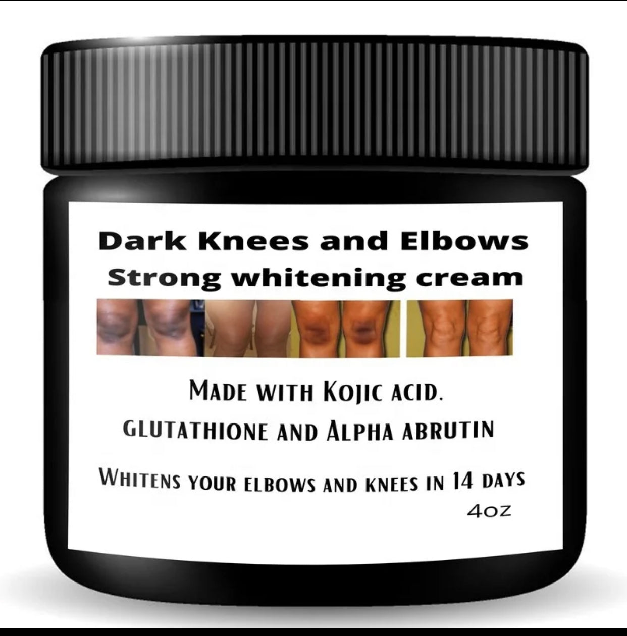 Dark knuckles cream, Potent  Cream , Dark Spots remover, Real results