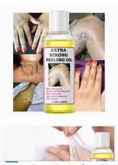 Yellow Peeling Oil, Peeling Oil for Dark Skin, Strong Peeling Oil Extra Strength, Exfoliating Peeling Solution for Body All Skin Type Dead Skin Remover (1PC)