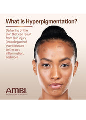 Ambi Even & Clear Fade Cream, Hyperpigmentation Treatment, Dark Spot Corrector.