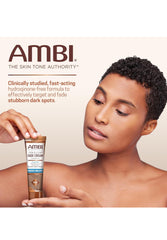 Ambi Even & Clear Fade Cream, Hyperpigmentation Treatment, Dark Spot Corrector.