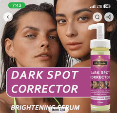 5D Gluta Dark Spot Corrector Penetrate Deeply Into The Skin Remove Acne Age Sun Marks Freckles (4 PACKS)