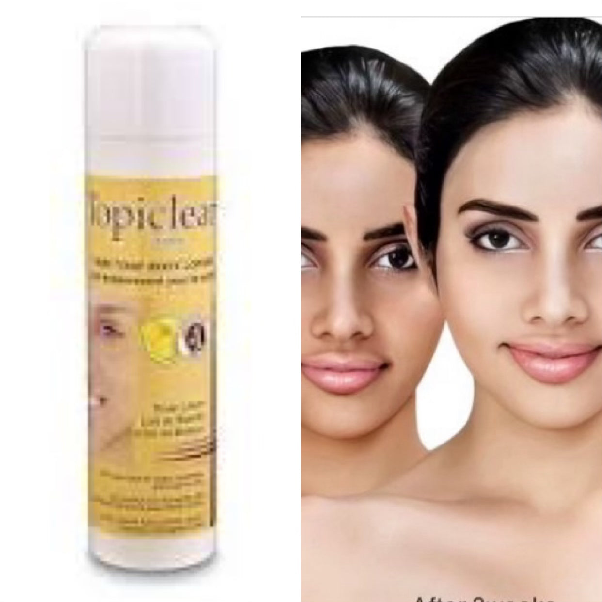 Topiclear Lemon Skin Lightening Body Lotion 16.8 oz Topiclear