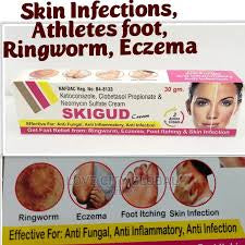 Skigud Cream 30g Fast Relief from Ringworm, Ezcema, Foot itching, & Skin Infection