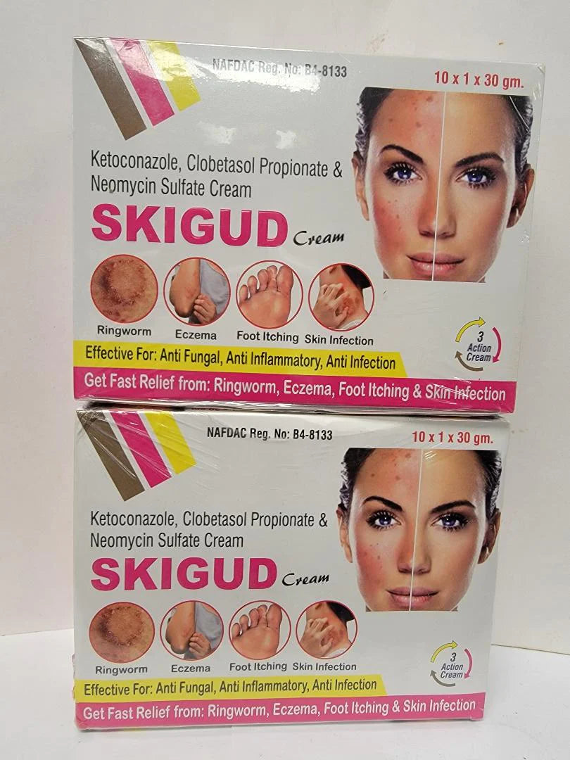 Skigud Cream 30g Fast Relief from Ringworm, Ezcema, Foot itching, & Skin Infection RoyalGlow Organics