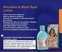 KNUCKLES & BLACK SPOTS CONCENTRATED CLARIFYING LOTION RoyalGlow Organics