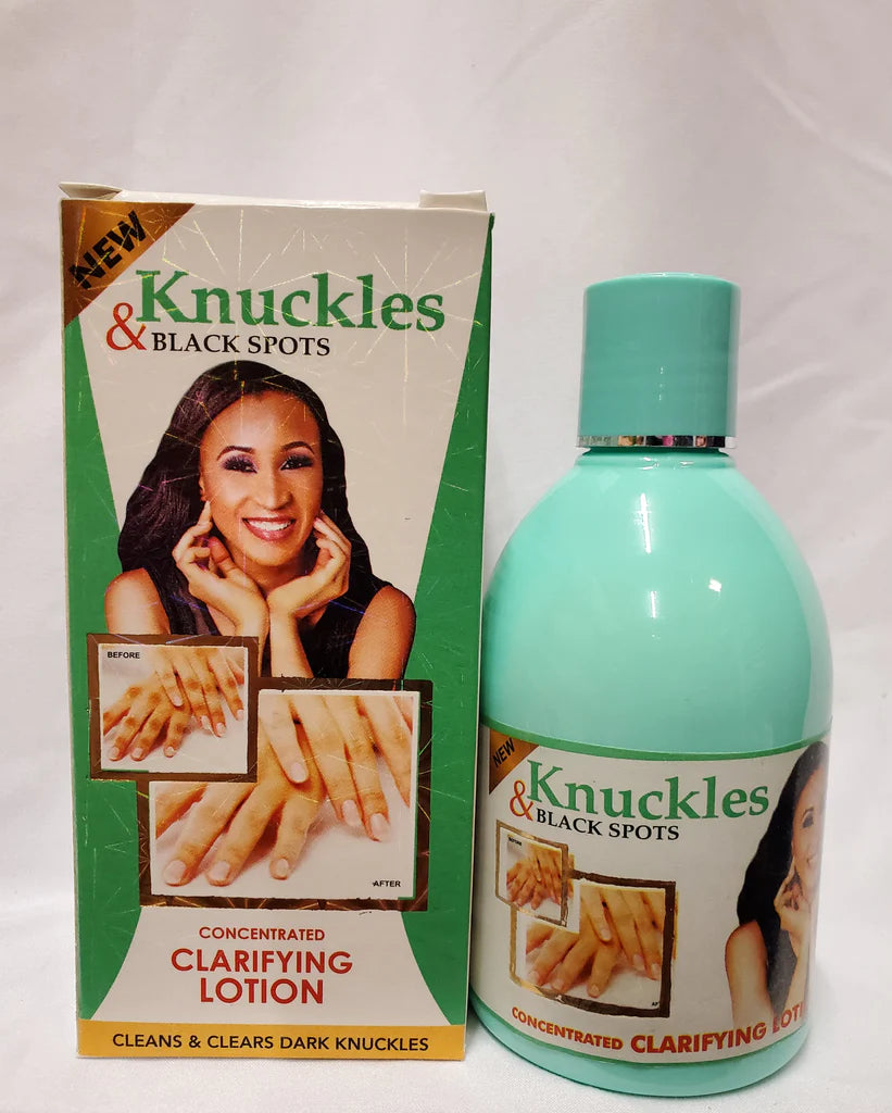 KNUCKLES & BLACK SPOTS CONCENTRATED CLARIFYING LOTION RoyalGlow Organics