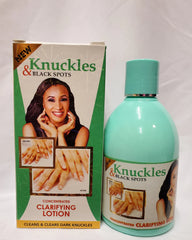 KNUCKLES & BLACK SPOTS CONCENTRATED CLARIFYING LOTION RoyalGlow Organics