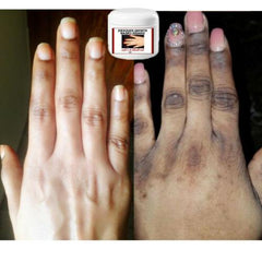 Magic White Code Secret Super Lighting Solution Dark Knuckle Remover RoyalGlow Organics