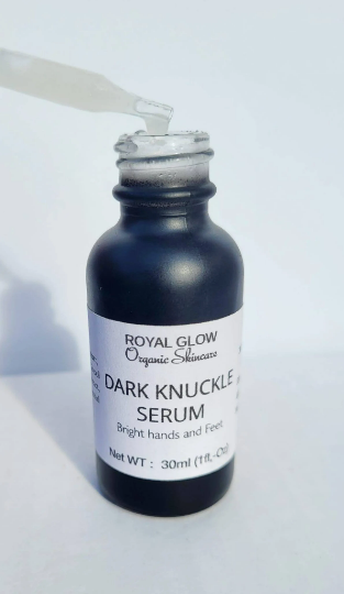 Dark knuckles cream, Potent  Cream , Dark Spots remover, Real results RoyalGlow Organics