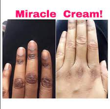 KENACOL WITH VITAMIN C Super Lighting Solution Dark Knuckle Remover RoyalGlow Organics