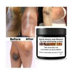 Dark knuckles cream, Potent  Cream , Dark Spots remover, Real results RoyalGlow Organics