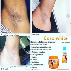 Caro White Complete Beauty Package. Real stuff! Carowhite