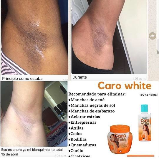 Caro White Lightening Beauty Cream With Carrot Oil 300 ml (1 PACK) Carowhite