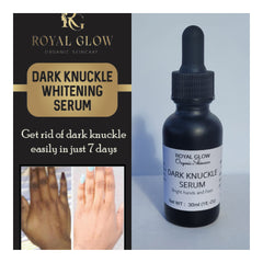 Fast Super Lightening Solution Dark Knuckle Remover RoyalGlow Organics