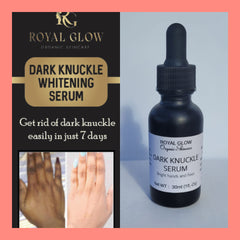 Fast Super Lightening Solution Dark Knuckle Remover RoyalGlow Organics