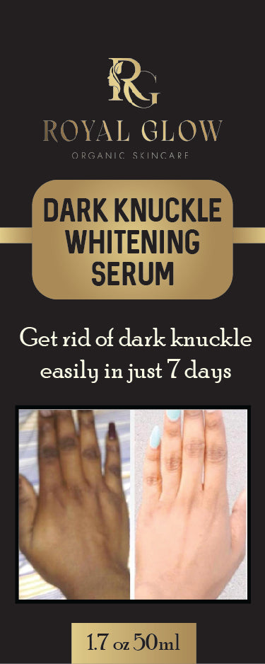 Fast Super Lightening Solution Dark Knuckle Remover RoyalGlow Organics