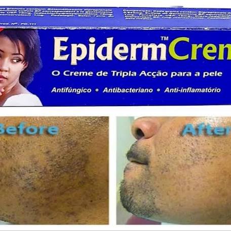 Epiderm Fast Action Crème 1oz/30g epiderm